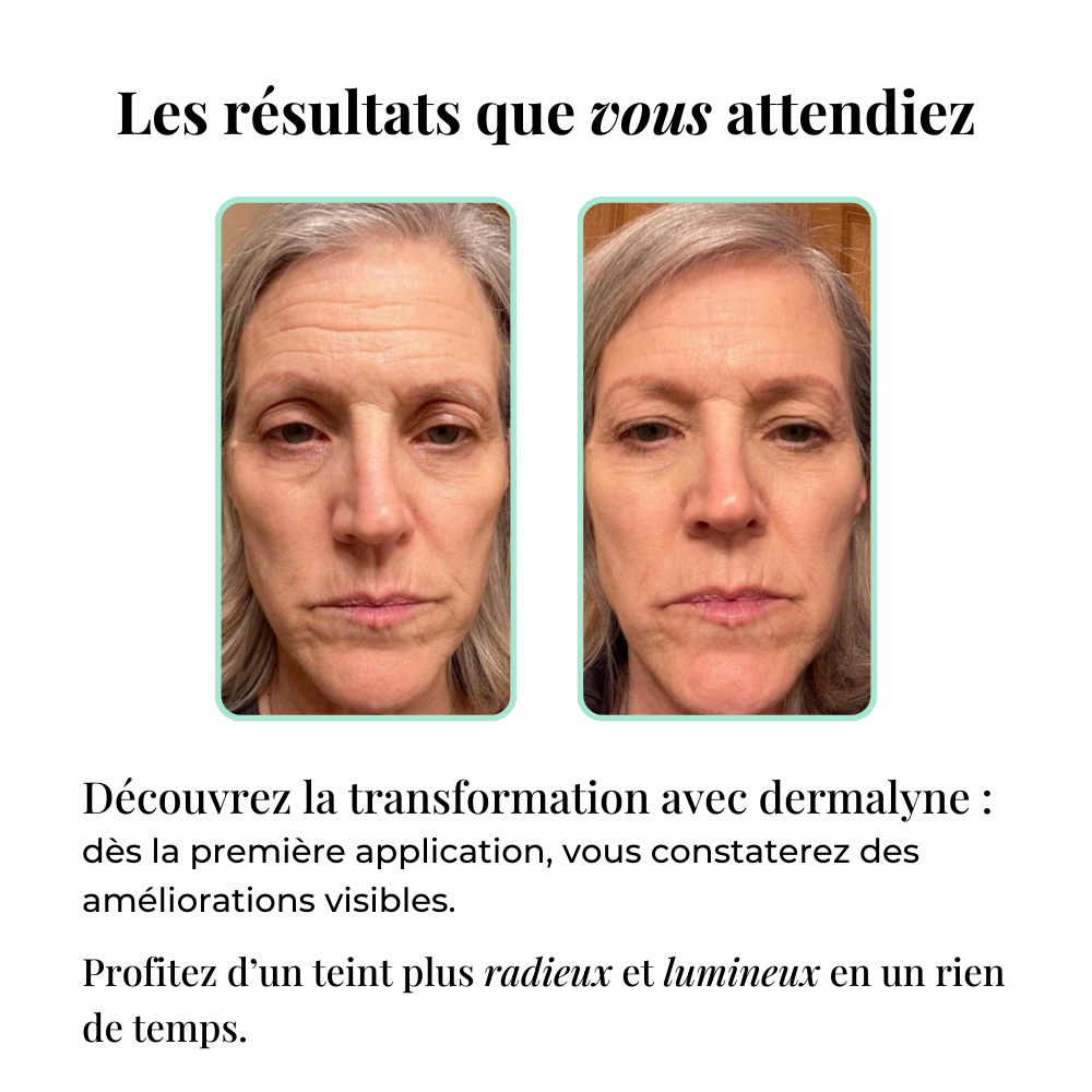 Micro-infusion Lift Expert + sérum extra offert