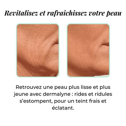 Micro-infusion Lift Expert + sérum extra offert